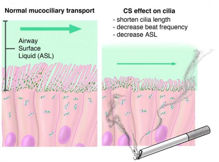 Smoking diminishes ciliary action and eventually destroys the cilia